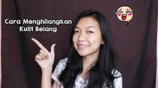 Cara Menghilangkan Kulit Belang Secara Alami  Desty Yufenti [upl. by Shumway]