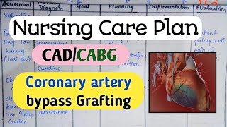 Nursing Care Plan on CABGCADNursing processNursing Diagnosis nursingcriteria [upl. by Akinat214]