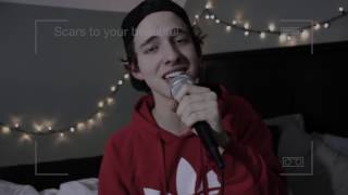 SCARS TO YOUR BEAUTIFUL  ALESSIA CARA COVER [upl. by Aerdnod]