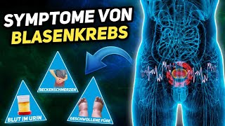 7 Symptome von Blasenkrebs die jeder kennen sollte [upl. by Per112]