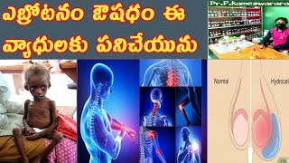 Abrotanum Homeopathic Medicine For MarasmusHydroceleJoint Pains amp Loose Stools In Telugu [upl. by Sklar]