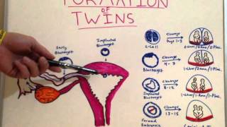 Formation of Twins  Embryology Video for Medical Students  USMLE Step 1 [upl. by Gaylor]