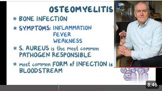 Osteomyelitis  Definition  Causes  Pathogenesis  Diagnosis  Treatment Dr John Campbell [upl. by Scrogan]