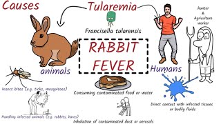 Tularemia Rabbit Fever Symptoms Pathogenesis Diagnosis Treament [upl. by Liba]