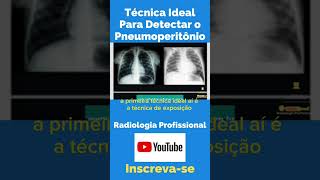 Técnica Ideal Para Detectar o Pneumoperitônio shorts tecnologoemradiologia amigosdaradiologia [upl. by Aisiram]