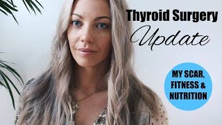 Thyroid Surgery Update  My scar fitness amp nutrition 1 year later [upl. by Eshman812]