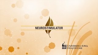 Health at Iowa  Neurostimulator [upl. by Ramos966]