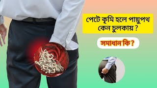 পেটে কৃমি হলে পায়ুপথ চুলকায় কেন।। মলদ্বারে কৃমির চুলকানি।। আপনার করণীয় কি [upl. by Platon]