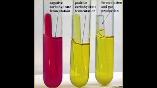 Sugar Fermentation Test [upl. by Reaht]