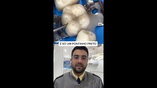 DENTISTA reage a PONTINHO PRETO [upl. by Reinnej]