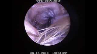 VIDEO OTOSCOPY OF A CANINE EAR CANAL [upl. by Enyrhtac]