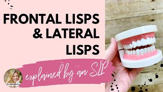 FRONTAL LISP VS LATERAL LISP explained by an SLP [upl. by True]