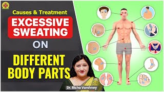 How To Stop Excessive Sweating  Acupressure Points  Dr Richa Varshneys Free Online Training [upl. by Steve]