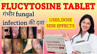 Flucytosine capsule uses in hindi  Flucytosine in hindi  flucytosine [upl. by Hogue322]