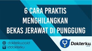 6 Cara Praktis Menghilangkan Bekas Jerawat Di Punggung [upl. by Acirderf828]