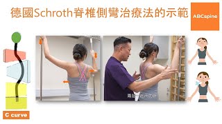 物理治療師  鄭進成 Aldous 示範德國Schroth脊椎側彎治療法單胸彎 [upl. by Akinorev]