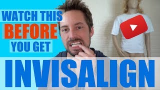 WHAT IS INVISALIGN [upl. by Annehs516]