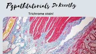 Masson trichrome stain [upl. by Aihtyc]