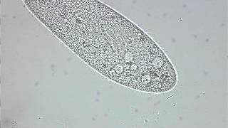 paramecium contractile vacuole [upl. by Ediva]