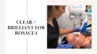 Clear  Brilliant for Rosacea  Live [upl. by Sanger]