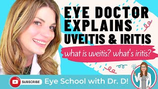 What Is Uveitis  An Eye Doctor Explains Uveitis And Iritis  How Uveitis And Iritis Are Treated [upl. by Alexi]