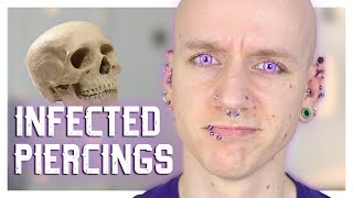 Infected Piercings amp How To Heal Them  Piercing FAQ 21  Roly [upl. by Ramo]