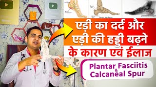 ऐड़ी के दर्द और ऐड़ी की हड्डी बड़ने का घरेलू ईलाज । Plantar Fasciitis amp HeelCalcaneal Spur viral [upl. by Katharyn861]