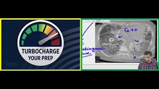 Rapid Revision medicine l session 3 [upl. by Payson]