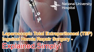 Laparoscopic Total Extraperitoneal TEP Inguinal Hernia Repair Surgery  Explained [upl. by Kuehn851]