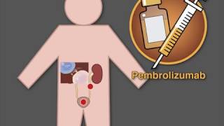 Pembrolizumab as Secondline Therapy for Advanced Urothelial Carcinoma [upl. by Mccandless253]