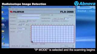 Radioisotope Image Detection [upl. by Eisenhart140]