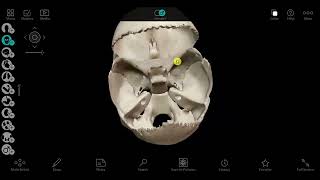 Skull and cervical vertebra 2 [upl. by Ilowell49]