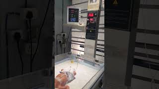 Newborn babies are very serioussumitnicunursingstm youtubeshorts nursing newbornbaby viralshort [upl. by Jarek403]