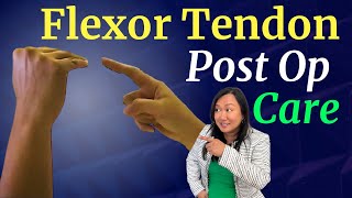 Flexor Tendon Surgery  Post Op Care and Wound Cleaning [upl. by Naneik]