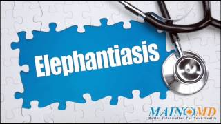 Elephantiasis ¦ Treatment and Symptoms [upl. by Stoddart334]