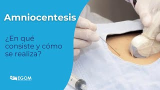 🫃Amniocentesis ¿qué es y para qué sirve esta prueba diagnóstica [upl. by Bowen82]