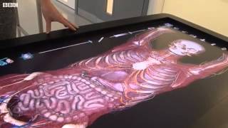 Virtual surgery How to dissect a digital cadaver [upl. by Ocicnarf]