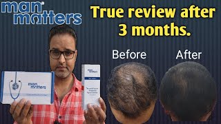 Man matters hair regrowth treatment 3 months honest review manmatters hair [upl. by Alrats]