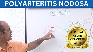 Polyarteritis Nodosa Clinical Features  Complications  Management [upl. by Dalton220]