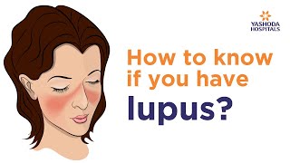 Systemic Lupus Erythematosus SLE Symptoms Diagnose And Treatment  Rheumatology [upl. by Ytsirhc]