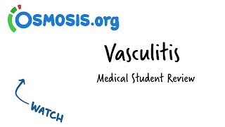 Vasculitis  Clinical Presentation [upl. by Elocan]