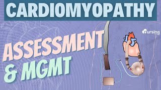 Cardiomyopathy Assessment and Management Cardiac Nursing [upl. by Gombach]