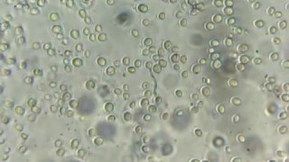 Observation de cellules de levure  Saccharomyces cerevisiae [upl. by Violante204]