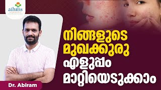 ACNE VULGARIS MALAYALAM  നിങ്ങളുടെ മുഖക്കുരു എളുപ്പത്തില്‍ എങ്ങനെ മാറ്റിയെടുക്കാം  Dr ABHIRAM VK [upl. by Neyut]