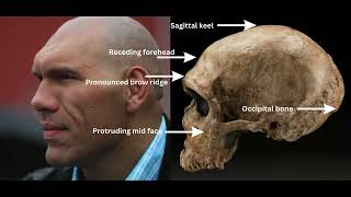 6 Neanderthal DNA physical traits in modern humans [upl. by Niassuh]