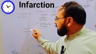 infarction  infarction pathology in urduinfarction general pathology  myocardial infarction❤️‍🔥 [upl. by Domenic]