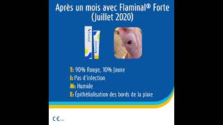 Étude de cas  traitement dun ulcère artériel avec Flaminal® [upl. by Eba]