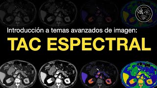 Introducción a TAC Espectral [upl. by Eirek]