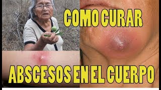 Como CURAR ABSCESOS EN EL CUERPO con Barbasco cubé  SECRETOS DE LA ABUELITA  remedio casero [upl. by Nicolea]