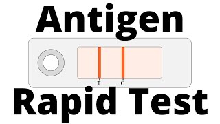 How SARSCoV2 Antigen Rapid Tests work Covid19 Testing [upl. by Kenimod]